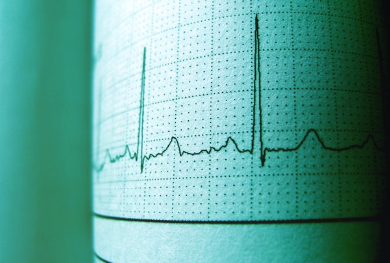 ECG Image